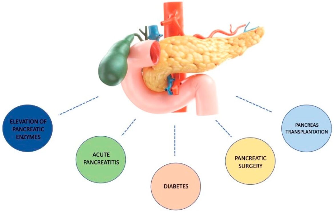 pancreatic enzymes